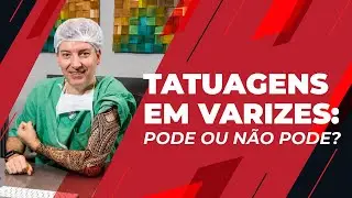 Могу ли я сделать татуировки, чтобы скрыть варикозное расширение вен?