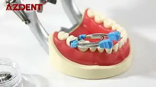AZDENT Dental Matrix Sectional Contoured Matrices Clamps Wedges