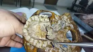 Exploring the Norma Basalis &ndash; base of the skull