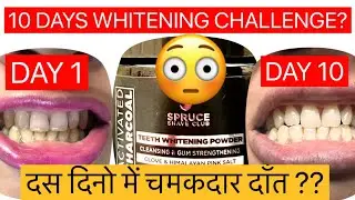 |Activated  charcoal whitening powder|10 days challenge|#dental #activatedcharcoal#teethwhitening