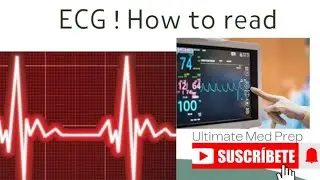 Electrocardiogram ECG  easy explaination #medicalstudies #cardiology #heartphysiology