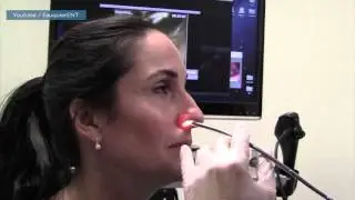 Self-propelled powder stops severe bleeding