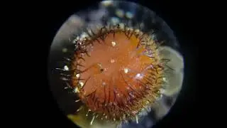 Scutellinia setosa