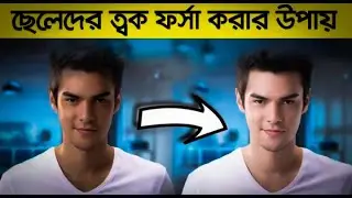 Cheleder Face Forsa Korar Upay- Cheleder Face Cream (ছেলেদের মুখের কালো দাগ দূর করার উপায়)