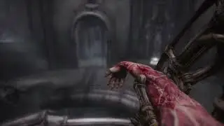 Scorn scene being put onto the mind transfer device at the end.