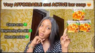 *Affordable* Bar soap that clears acne and gives you a healthy glowing skin #turmericandhoneysoap