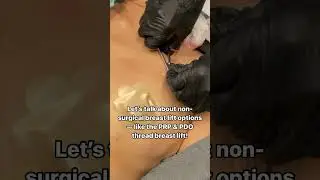 Maximize Your Natural Breast Lift Results with PRP + PDO Threads