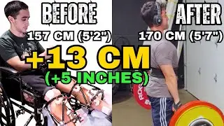From Wheelchair to Powerlifting: Adam's 5 inch Limb Lengthening Recovery Comeback (157cm &rarr; 170cm)