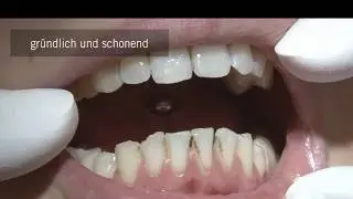 CleanJoy &ndash; Fluoridhaltige Zahnreinigungs- und Polierpaste | VOCO GmbH - Deutsch
