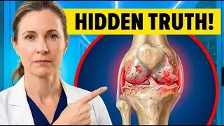 Over 65? The Hidden Truth About Arthritis Doctors Rarely Explain