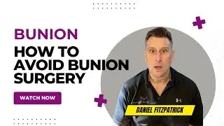 How To Avoid Bunion Surgery and Keep Active