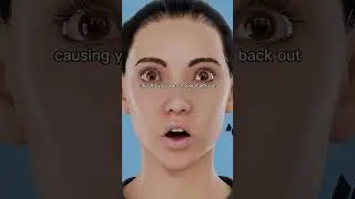 How Ear Pinning Works🤔