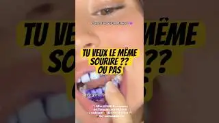 Blanchiment Dentaire INCROYABLE 😱 Avant/Apr&egrave;s R&eacute;v&eacute;l&eacute; ! #avantapres #live #dentsblanches #dentist