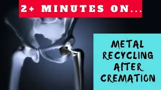 Where Do Medical Metal Implants Go After Cremation? Just Give Me 2 Minutes