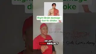 Right sided stroke/ brain 🧠 damage