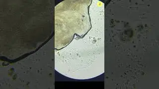 Acne Under The Microscope #shorts #microscope #underamicroscope #demodex