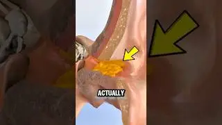 Stop Cleaning Out Your Ear Wax! Here&rsquo;s Why You Actually Need It