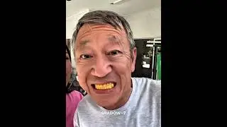 Yellow teeth filter prank 😱 #trollface #edit #birdtrend