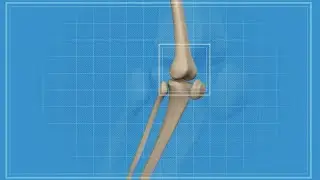 Scientists study stem cell injections to treat knee arthritis
