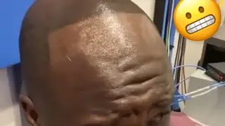 Shaq Showing Off His New Hairline 😬..