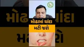 Modha ma chanda | Mouth ulcers will be cured | mouth ulcer |muh me chhale| Raj Parmar | Ayu Jivan Ayurved
