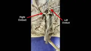Female Fetal Pig Repro