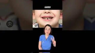 Why treat cavities in BABY teeth🐣
