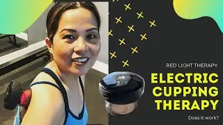 AchedAway Electric Cupping System Product Review | Cupping Therapy | Electric Massage Cupper