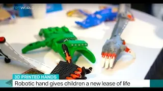 3D printed hands give children a new lease of life