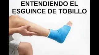 ¿Qué hacer si tengo un esguince crónico de tobillo?