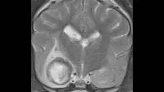 MRI Features of Canine Intracranial Intra-Axial Hematomas