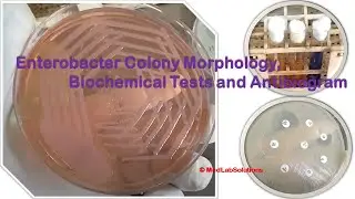 Enterobacter Colony Morphology, Biochemical Tests and Antibiogram Demonstration