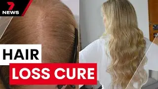 New pharmaceutical race to stop hair loss impacting four in every ten Australians | 7NEWS