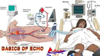 Basics of Extra corporeal Membrane Oxygenation | ECMO | Heart Lung Machine |   #HeartbeatsZ