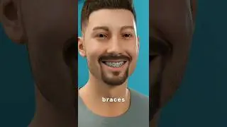 How Braces Actually Move Your Teeth (It's Not What You Think)