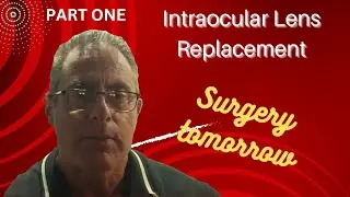 SURGERY TOMORROW - INTRAOCULAR LENS EXCHANGE TECNIS SYNERGY  PART ONE