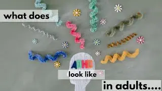 🎥 ADHD in Adults: The Invisible Struggle No One Talks About