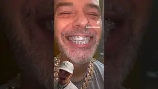 Эти бриллиантовые гриллзы от Johnny Dang сводят с ума! Диско-шар у рта! #шорты #грилзы #блестки
