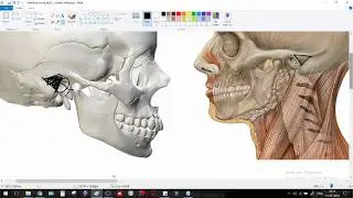 MacEwen's Triangle - Training in Surface anatomy (ENT / SURGERY / ANATOMY)