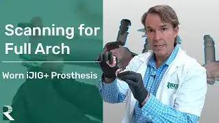 Scanning for Full Arch - Worn iJIG+ Prosthesis