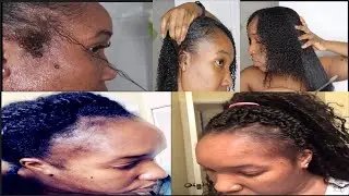 HOW ALOE VERA HELP MY DAMAGE EDGES GROW BACK FAST