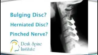 Deuk Spinal Institute - Laser Surgery 2010