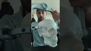 This is a skull clamp and the way we use jt. #neuro #brain #medical #doctor