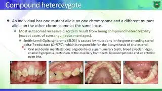 Genetic disorders and modes of inheritance part II