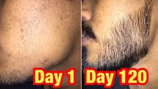 Four Month Beard Growth Time-Lapse