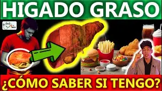 COMO SABER SI TENGO HIGADO GRASO | GuiaMed