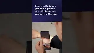 How do skin-checking apps work? - The Medical Futurist #shorts