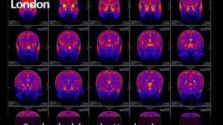 Cooler babies, better brains