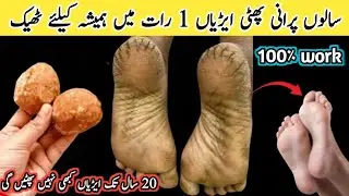 Hands feet repair cream | DIY hand & feet bleach | Hand whitening | Cracked Heels Repair Overnight👣