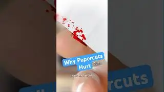 Why Do Papercuts Hurt